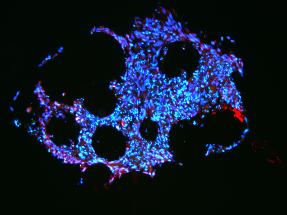 pancreatic differentiation beads